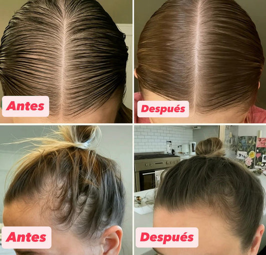 ✨50% OFF SOLO POR HOY | ROSEUM™ – El Sérum de Romero que Recupera tu Cabello 🌿💆‍♂️